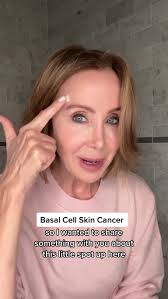 Sharing some personal news…I’ve been sporting a bandaid the past two weeks  after my Dermatologist @grossmandermatology biopsied a weird spot