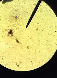 Coproparasitoscopico Microorganismos