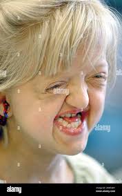 Brain surgeries hi-res stock photography and images