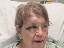 Sister injured in fall at church