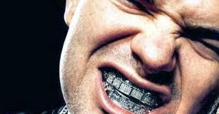 Make sure to bite down fully on the molding agent. Paul Wall And His Contributions To The Hip Hop And Grillz Culture Custom Gold Grillz