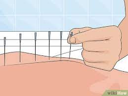 3 Ways To Treat Paresthesia - Wikihow