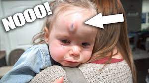 She Is So Tough One Year Old Gets A Massive Goose Egg Youtube