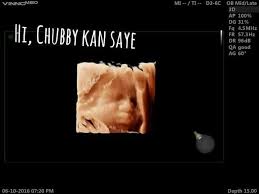 Lot 149, jalan tun razak, titiwangsa 18. Jom Intai Baby Klinik Pusrawi Maiwp Healthcare Sdn Bhd Facebook
