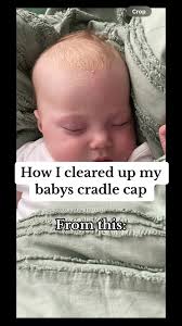 I Am Beth Has A High Cradle