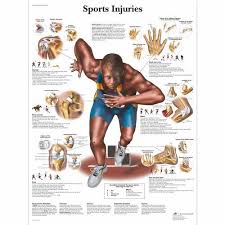 Sports Injuries Chart 4006664 Vr1188uu Muscle Sports Physical Therapy Athletic Training Sports Medicine Sports Therapy