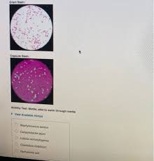 Natural habitats they are widely distributed in the environment they have been isolated from soil, decaying vegetables, sewage. Solved Gram Stain Is Capsule Stain Motility Test Motil Chegg Com