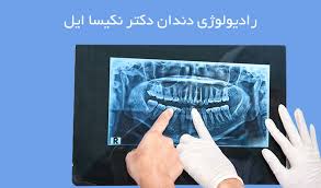 Image result for â«Ø±Ø§Ø¯ÛÙÙÙÚÛ Ø¯ÙØ¯Ø§Ùâ¬â