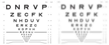 Presbyopes Visual Acuity From Refractive Error Problems With