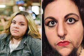I have tried birth control. Women With Pcos Explain Why They Celebrate Their Facial Hair Allure