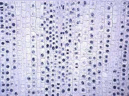 Onion root tip mitosis stages labeled. Onion Root Images
