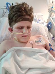 Cason is extubated and off the vent