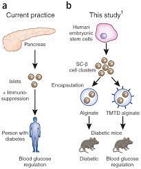 Approaching A Cure For Type 1 Diabetes | Nature Medicine