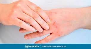Busco Empleo Medico Quito º Si Buscas Trabajo Aqui Tenemos Una Lista De Empleos En Tu Locali Cabello Y Unas Granos En La Barbilla Ofertas De Trabajo