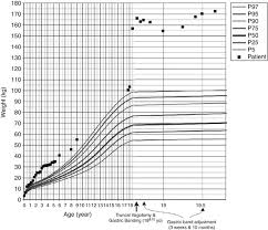 To make sure your child is on the right track, here's the median height and weight* of kids at four years and three months. Bariatric Surgery In A Patient With Complete Mc4r Deficiency International Journal Of Obesity