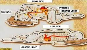 8 Answers Why Does Lying On My Left Side Immediately And Completely Relieve My Severe Abdominal Pain Quora