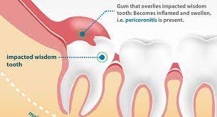 Pin On Dental