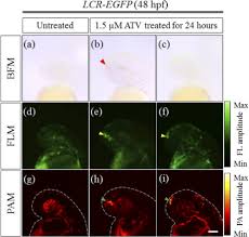 Check spelling or type a new query. Osa Label Free Photoacoustic Microscopy A Potential Tool For The Live Imaging Of Blood Disorders In Zebrafish