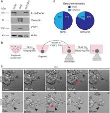 There are three types of ovarian tumors, each named for the tissue in which they are found: Multicellular Detachment Generates Metastatic Spheroids During Intra Abdominal Dissemination In Epithelial Ovarian Cancer Oncogene
