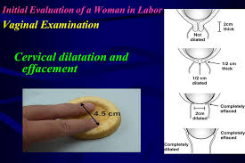 They are conducted to assess a birthing woman's 'progress' during labour. Abc Of Labour Care Yasser Orief By Ppt Video Online Download
