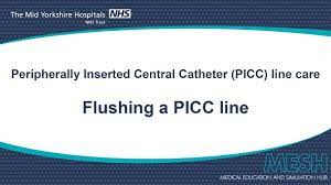 Local anesthesia may be used. Flushing A Picc Line Youtube