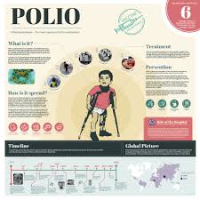 Image result for Polio