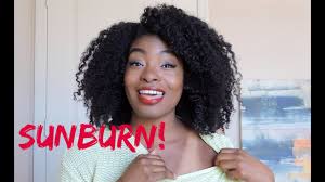 We did not find results for: Finding Beauty How To Heal Sunburn On Brown Skin Youtube