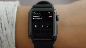 Fda Clears First Medical Accessory For The Apple Watch An Ekg Sensor Ars Technica No six degrees of apple watch. apple watch an ekg sensor