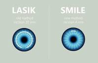 Is Smile Eye Surgery Safe? | Discover Vision