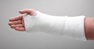 Kirik Kol Belirtileri Ve Tedavisi Kol Gen Tr