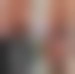 Image result for Labial Fusion