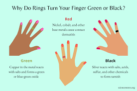 Why Do Rings Turn Your Finger Green Or Black?