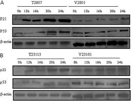 A 2017 study (zhang, f.f, et al) looked at more than 6,200 american and canadian women with breast cancer. The Role Of Tgfbi In Mesothelioma And Breast Cancer Association With Tumor Suppression Bmc Cancer Full Text