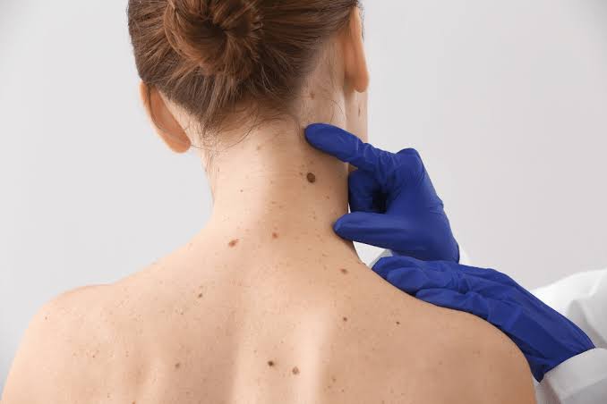  what does skin cancer look like 