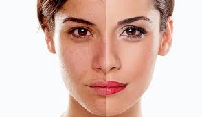 Most primary care doctors are trained the checklist: Skin Renewal Aesthetic Clinics Lasers Medical Skincare Botox