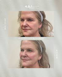 Amy Hatcher (@amyhatcher_botoxboss) • Instagram photos and videos