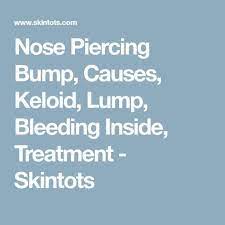 Pin By Maria Torres On Piercings Nose Piercing Bump Piercing Bump Nose Piercing