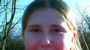 Teenager Electrocuted In Christmas Accident