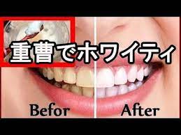 驚愕 あるもので歯を磨くと たった一週間で白い歯に youtube 歯 ホワイトニング ホワイトニング 白い歯