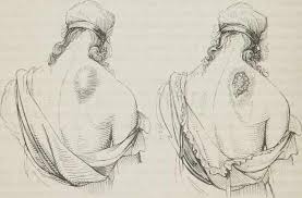 Le Furoncle En Reve Le Sens En 2020 Interpretation Des Reves Reve Psychique