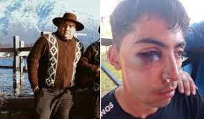 El manager de Sele Vera le desfiguró la cara a un sonidista en Dina Huapi