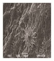 Image result for Phragmanthera capitata