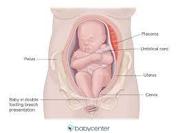 Fetal Presentation Before Birth Babycenter