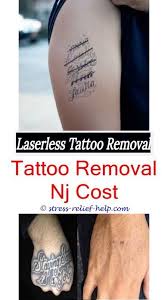 The costs of tattoo removal, primarily depends upon the type of procedure. How Do U Get Tattoos Removed How To Remove Black Henna Tattoo Fast How Much Does It Cost To Have A Tattoo Remove Black Henna Tattoo Removal Tattoo Removal Cost