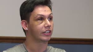 Man attacked in downtown Huntsville talks about experience, asks for  community to unite for fairness