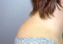 When used properly, these drugs save lives and avert threats to the function of important organs. Prednisone Johns Hopkins Vasculitis Center