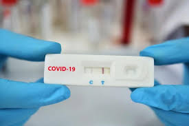 The two main branches detect either the presence of the virus or of antibodies produced in response to infection. Testare Covid 19 Antares Clinic