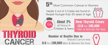 Thyroid Cancer Symptoms Risk Factors Diagnosis Treatment Prevention