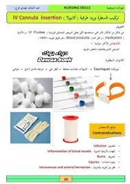 إزاي تركب cannula بالصور