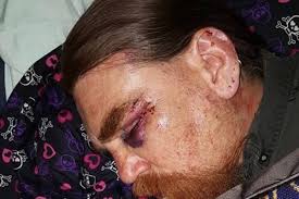 Man seriously hurt after alleged 'road rage'